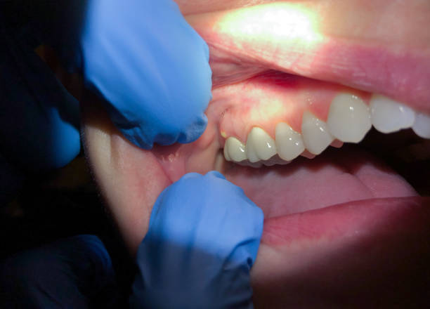 Best Knocked-Out Tooth Emergency  in Stanley, ND