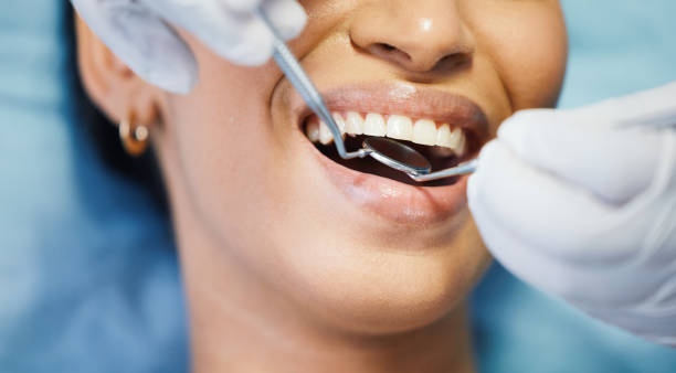 Best Dentist for Dental Trauma  in Stanley, ND