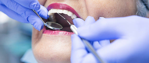 Teeth Whitening in ND